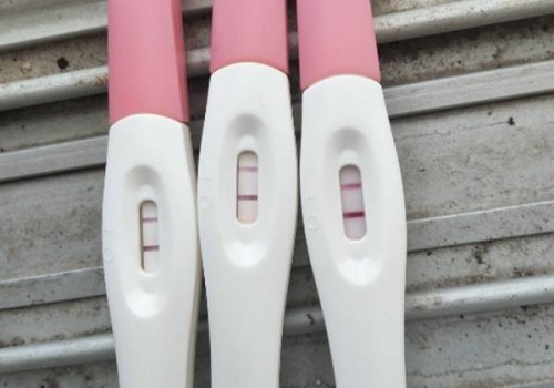 婴儿头皮隆起别担心，一文解读婴儿头皮隆起的原因