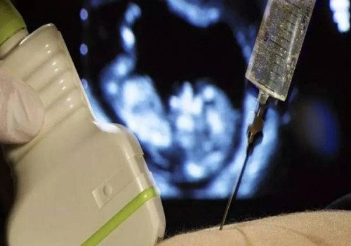 2022男性一旦患有输精管堵塞会有哪些表现-