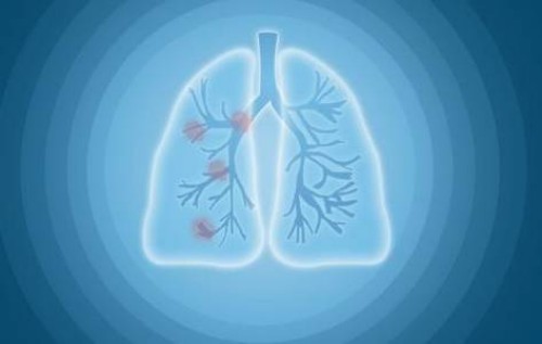 促排让你避免出现空卵泡的妙招，日常吃什么很关键