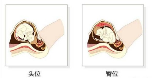 过来人分享艾灸治疗月经不调的效果，好不好一看便知