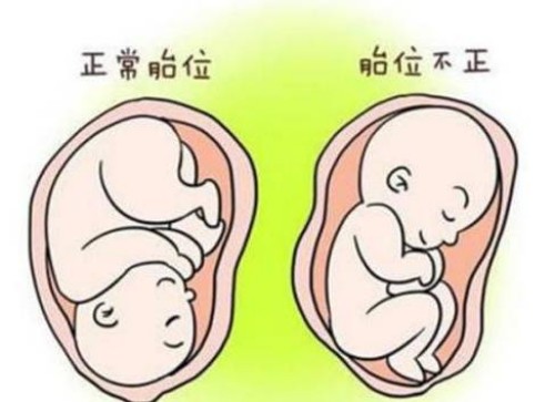 宁波助孕：三代筛查不合格仍然想要移植？能够接受这些风险就可以继续