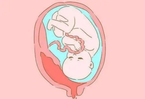 宁波助孕生子：湿气最害怕这三种水果，湿气重的人一定要吃