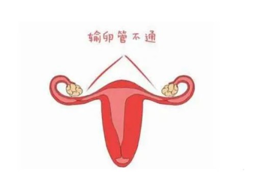宁波助孕公司：备孕夫妻这样做更容易怀孕，照这样做让你更快当爸妈