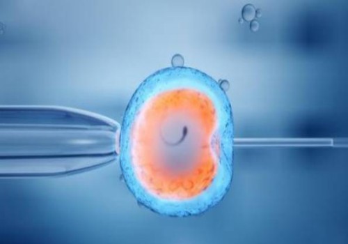 羊水穿刺染色体报告解读：是男孩还是女孩一目了然！