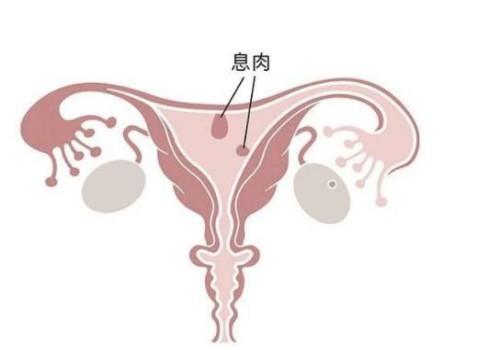 宁波正规助孕机构：睾丸越多生育能力越强不可信，多睾症有什么危害